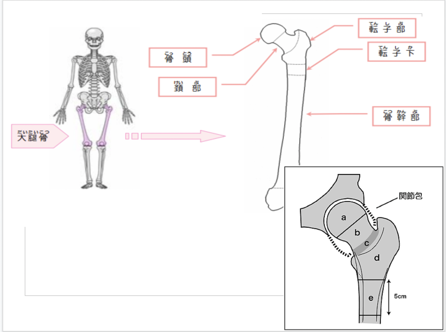 大腿骨骨折はどのように治療されますか?