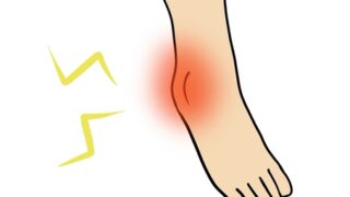 足関節捻挫即緩和メソッド 足関節捻挫即緩和メソッド
